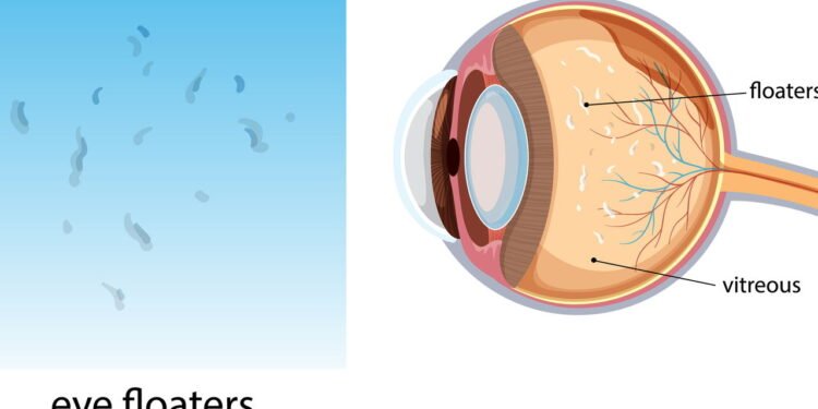 Moscas Volantes - Créditos: depositphotos.com / blueringmedia