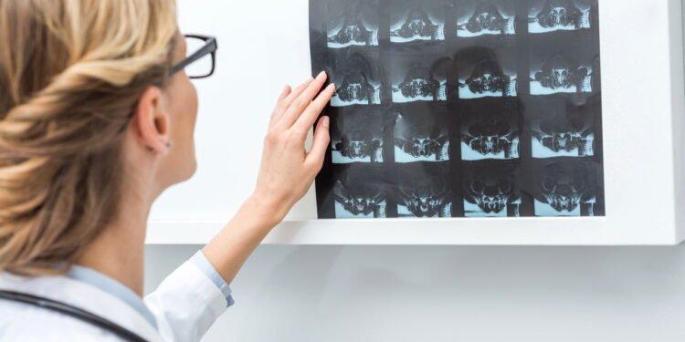 O exercício simples que ajuda a fortalecer os ossos após os 60