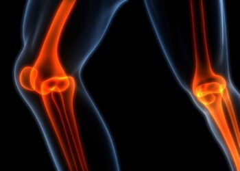 O exercício simples que ajuda a fortalecer os ossos após os 60