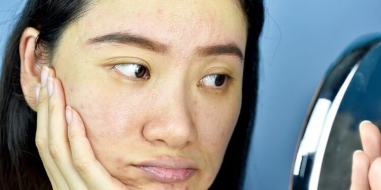 pele sem brilho - Créditos: depositphotos.com / Artfully79