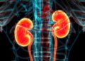 Coisas que você talvez não saiba sobre doença renal