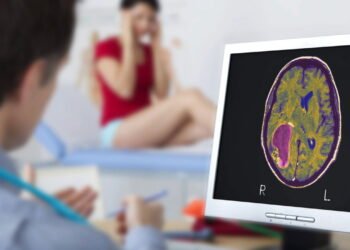 Dr. Baltazar Leão, Neurocirurgião: o sintoma mais ignorado que pode indicar tumor cerebral