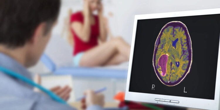 Tumor cerebral - Créditos: depositphotos.com / imagepointfr