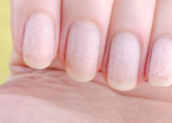 Por que suas unhas ficam amareladas do esmalte e ninguém te conta