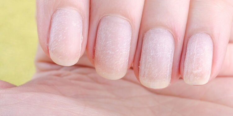 Por que suas unhas ficam amareladas do esmalte e ninguém te conta