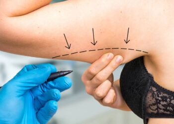 Fortaleça braços e evite flacidez com treinos certos