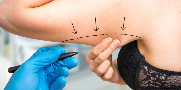 Braços Flácidos - Créditos: depositphotos.com / andriano_cz