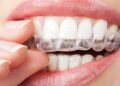 3 tratamentos para clarear os dentes rapidamente