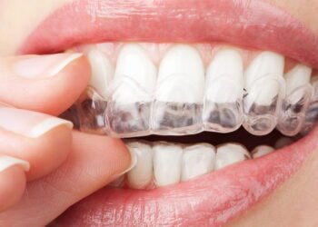 3 tratamentos para clarear os dentes rapidamente