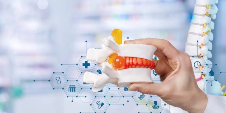 Hérnia de Disco - Créditos: depositphotos.com / NataliMis