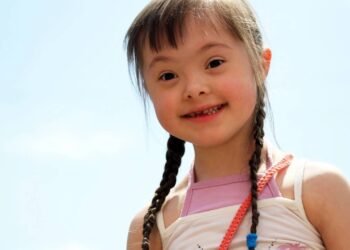 Síndrome de Down revela pistas inéditas sobre o Alzheimer