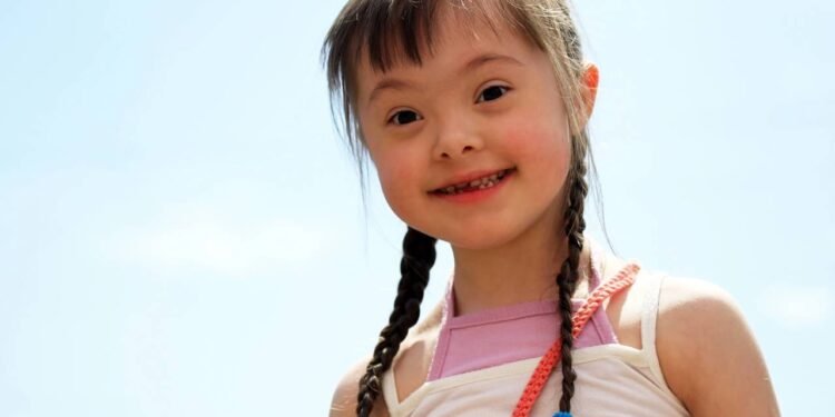 Síndrome de Down - Créditos: depositphotos.com / DenysKuvaiev