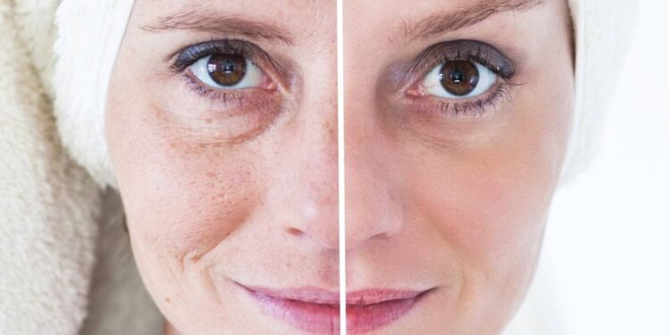 Esses compostos naturais contribuem para a prevenção do envelhecimento precoce - Créditos: depositphotos.com / melis82