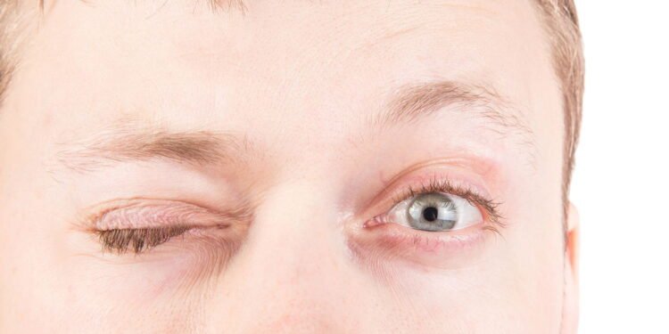 O que a frequência de piscar os olhos diz sobre seu nível de estresse