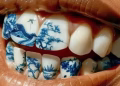 Moda de tatuagens nos dentes preocupa dentistas