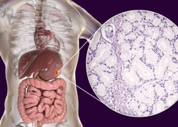 Câncer gástrico: como reconhecer os sintomas e quais mudanças na dieta os especialistas aconselham
