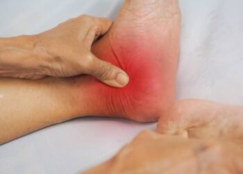 Dor no calcanhar pode ter alívio rápido com palmilhas e alongamentos certos