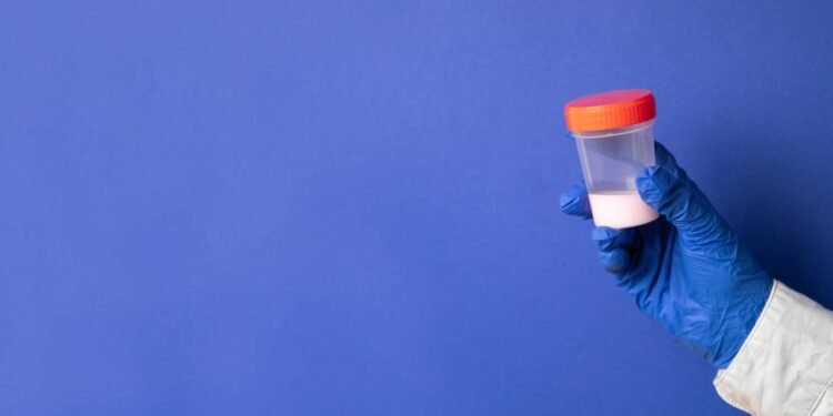 Esperma - Créditos: depositphotos.com / irinashatilova