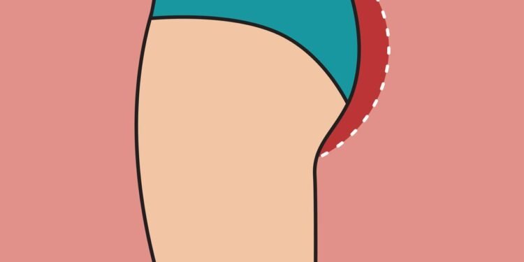 O melhor exercício para o aumento de glúteos