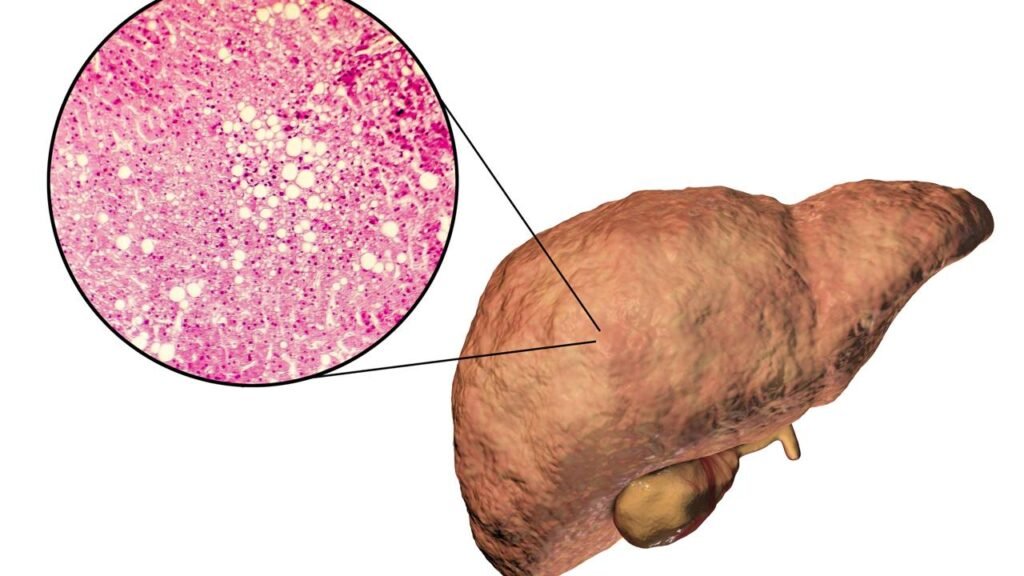 5 maneiras de verificar o fígado gorduroso em casa, de acordo com o gastroenterologista treinado em Harvard