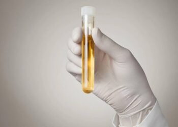 A presença dessa proteína  na urina pode sinalizar risco de demência