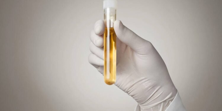 Urina - Créditos: depositphotos.com / Vonschonertagen