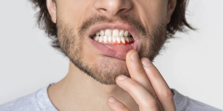 O que uma gengiva ruim pode revelar sobre a saúde do seu cérebro