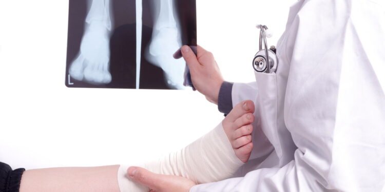 Esse sinal no tornozelo indica que ainda não é hora de voltar ao treino