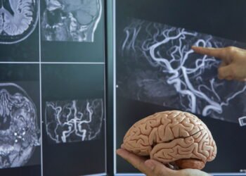 Monitor cerebral não invasivo detecta alterações críticas no cérebro