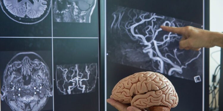 monitor cerebral - Créditos: depositphotos.com / srikijt