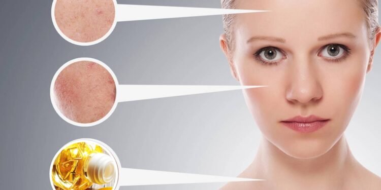 O óleo de girassol é amplamente utilizado em formulações dermatológicas - Créditos: depositphotos.com / evgenyataman / Créditos: depositphotos.com / Sasajo