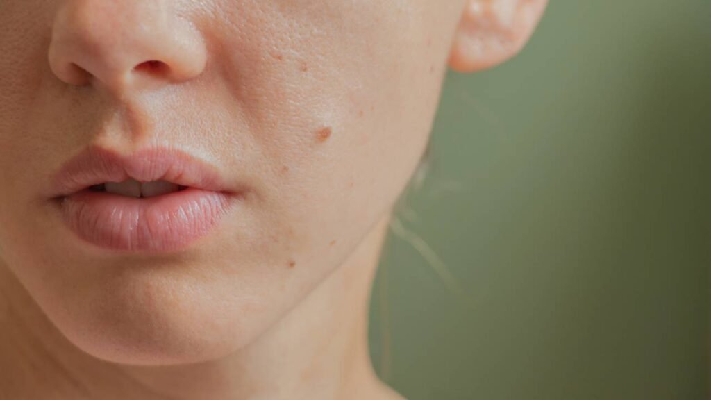 O que significa ter uma pinta perto da boca?