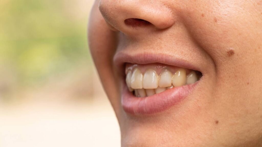 O que significa ter uma pinta perto da boca?