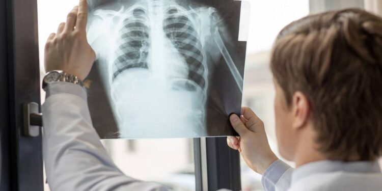 Raio-x - Créditos: depositphotos.com / SvyatLipinskiy
