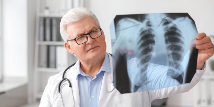 Edema Pulmonar - Créditos: depositphotos.com / serezniy