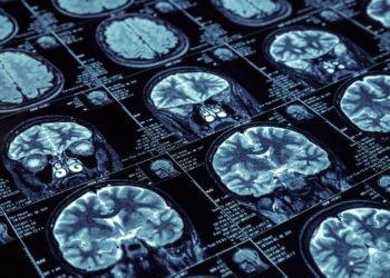 Dr. Cesar Cimonari: realidade aumentada transforma cirurgias cerebrais em 2025