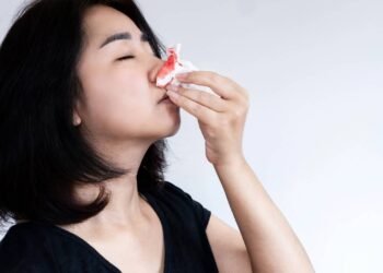 Como parar sangramento nasal rápido