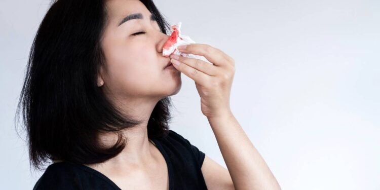 Sangramento Nasal - Créditos: depositphotos.com / doucefleur