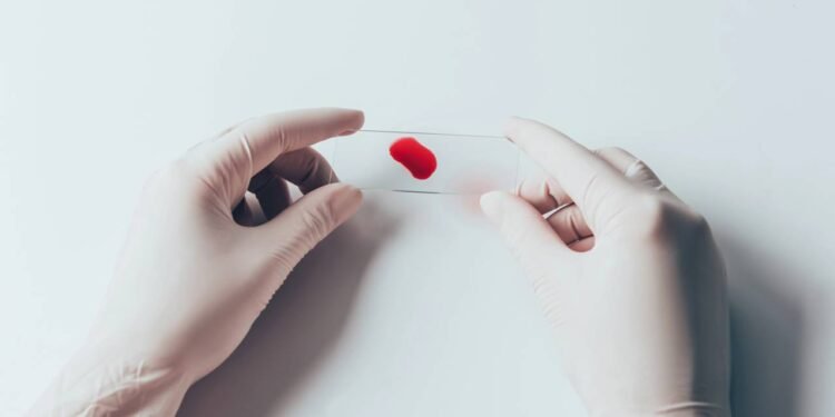 Sangue - Créditos: depositphotos.com / KateNovikova