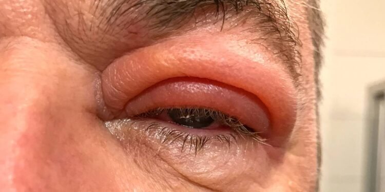 Terçol - Créditos: depositphotos.com / info.michaelheim-photographer.com