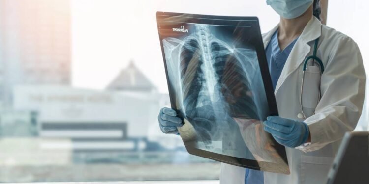 Tuberculose - Créditos: depositphotos.com / Chinnapong