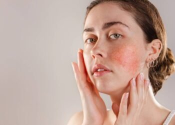 Por que o rosto fica vermelho? Veja as causas