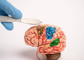 O avanço cirúrgico que permite operar o cérebro com o paciente acordado