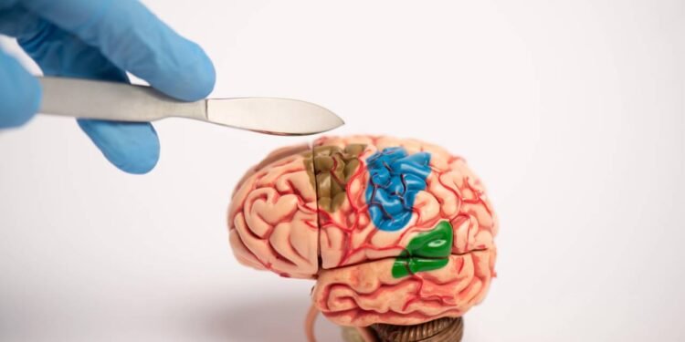 Cirurgia Cerebral - Créditos: depositphotos.com / IgorVetushko