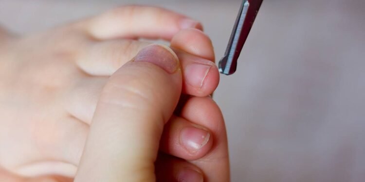 Manter uma rotina de cuidados é fundamental para garantir unhas fortes e bonitas - Créditos: depositphotos.com / sharafmaksumov