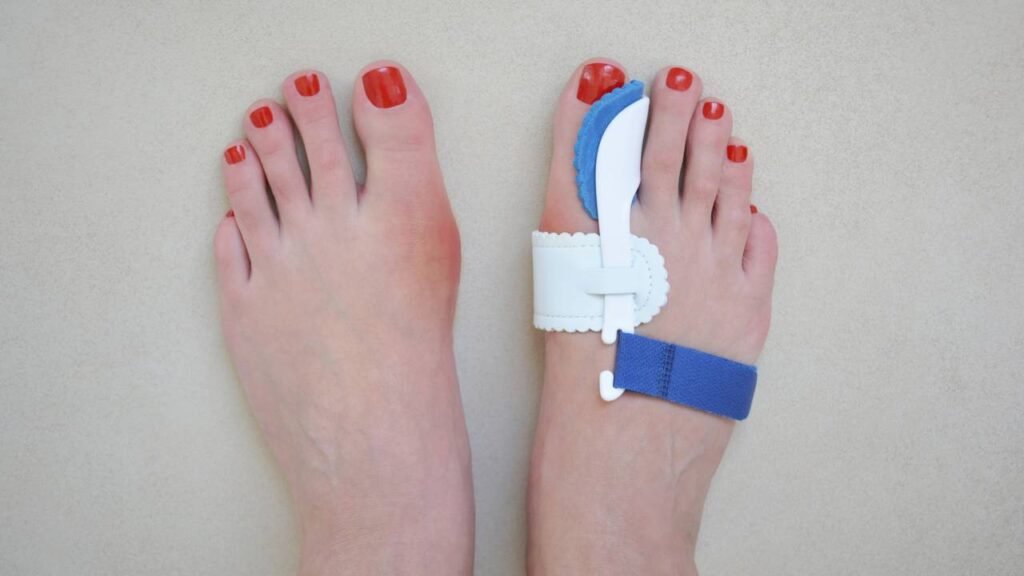 Por que os joanetes aparecem e como evitá-las em estágios iniciais