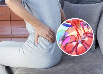 Quais são os primeiros sinais de alerta de pedras nos rins?