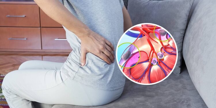 Quais são os primeiros sinais de alerta de pedras nos rins?