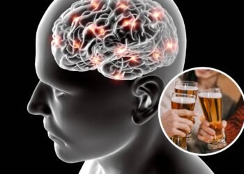 Consumo de álcool está associado a sangramento cerebral grave, diz novo estudo