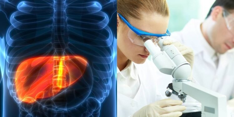 Estudos revelam os verdadeiros sintomas de câncer no fígado